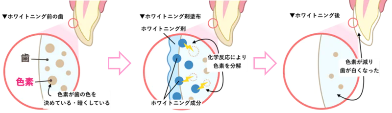 色素を分解する